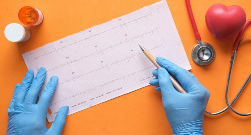 Resistenza all'insulina e malattie cardiovascolari: una connessione pericolosa